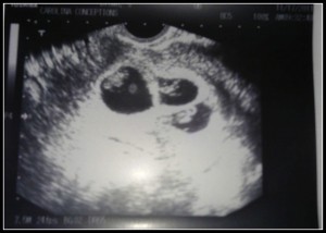 times3 7w5d triplets